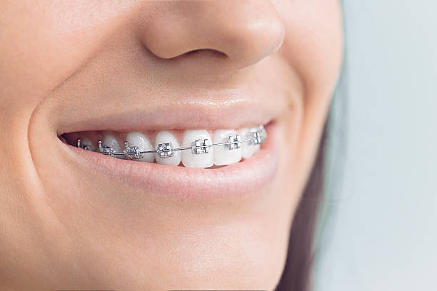 Best Teeth Whitening  in Ridgeland, MS